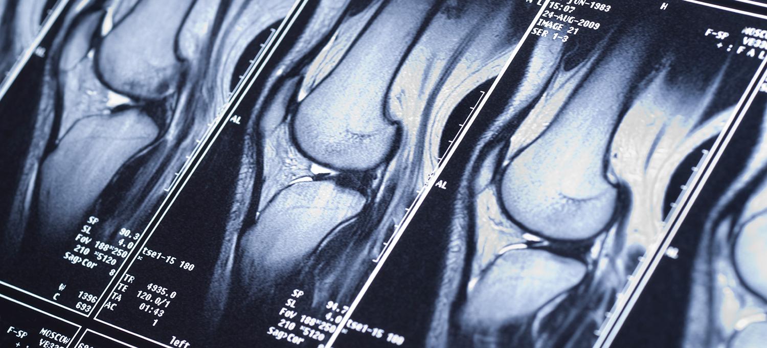 fastmri